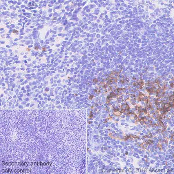 Immunohistochemistry (Formalin/PFA-fixed paraffin-embedded sections) - Anti-CD134 / OX40L receptor antibody [EPR22229-5] (AB229021)