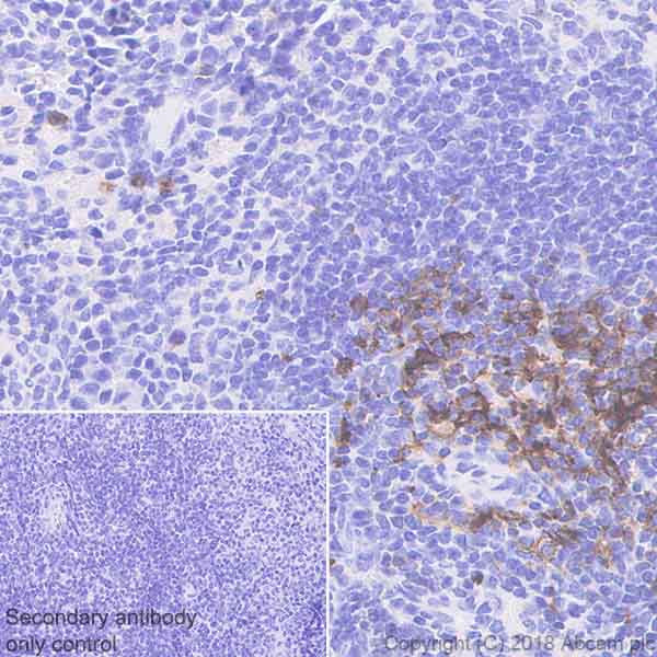 Immunohistochemistry (Formalin/PFA-fixed paraffin-embedded sections) - Anti-CD134 / OX40L receptor antibody [EPR22229-5] - BSA and Azide free (AB242024), expandable thumbnail