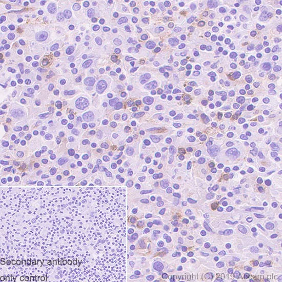 Immunohistochemistry (Formalin/PFA-fixed paraffin-embedded sections) - Anti-CD134 / OX40L receptor antibody [EPR23000-42] - BSA and Azide free (AB264470)