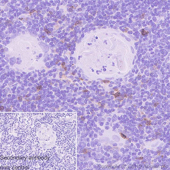 Immunohistochemistry (Formalin/PFA-fixed paraffin-embedded sections) - Anti-CD134 / OX40L receptor antibody [EPR23000-42] - BSA and Azide free (AB264470)