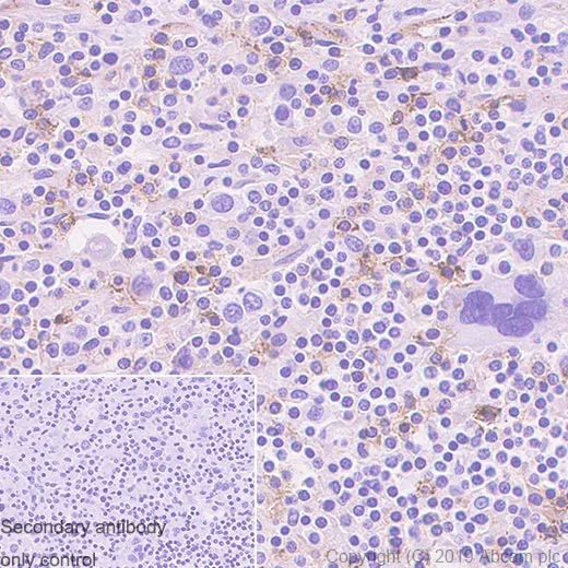 Immunohistochemistry (Formalin/PFA-fixed paraffin-embedded sections) - Anti-CD134 / OX40L receptor antibody [EPR23001-88] - BSA and Azide free (AB264469)