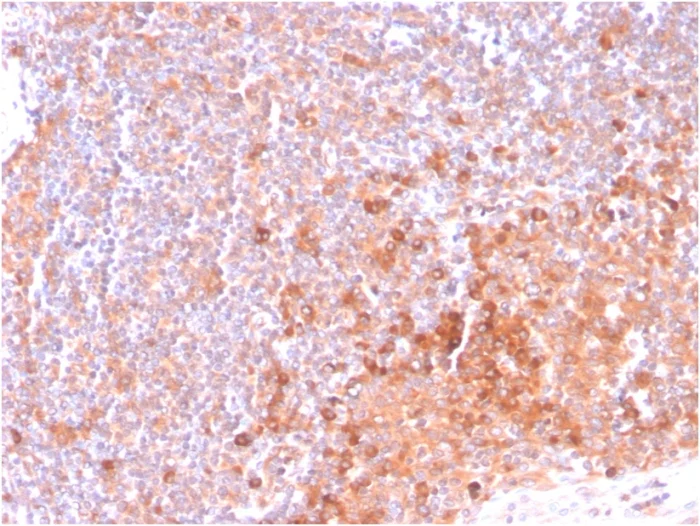 Anti-CD134 / OX40L receptor antibody [OX40/3108] (ab270727) | Abcam