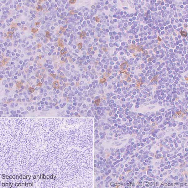 Immunohistochemistry (Formalin/PFA-fixed paraffin-embedded sections) - Anti-CD134 / OX40L receptor antibody [SP195] - BSA and Azide free (AB245756)