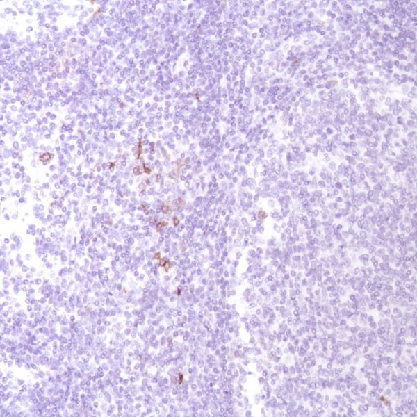 Immunohistochemistry (Formalin/PFA-fixed paraffin-embedded sections) - Anti-CD134 / OX40L receptor antibody [SP195] - C-terminal (AB228464), expandable thumbnail