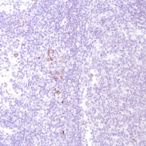 Immunohistochemistry (Formalin/PFA-fixed paraffin-embedded sections) - Anti-CD134 / OX40L receptor antibody [SP195] - C-terminal (AB228464)