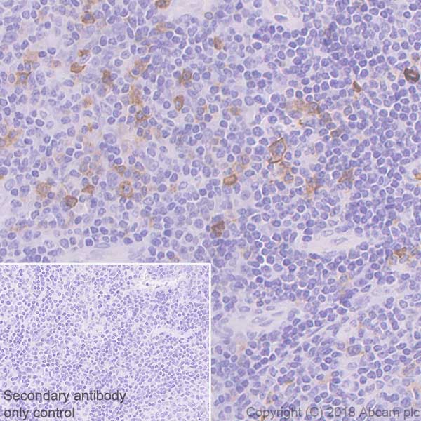 Immunohistochemistry (Formalin/PFA-fixed paraffin-embedded sections) - Anti-CD134 / OX40L receptor antibody [SP195] - C-terminal (AB228464), expandable thumbnail