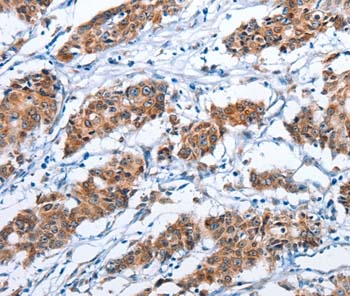 Immunohistochemistry (Formalin/PFA-fixed paraffin-embedded sections) - Anti-CD137 antibody (AB197942)