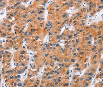 Immunohistochemistry (Formalin/PFA-fixed paraffin-embedded sections) - Anti-CD137 antibody (AB197942)