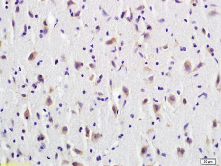 Immunohistochemistry (Formalin/PFA-fixed paraffin-embedded sections) - Anti-CD137 antibody (AB203391)