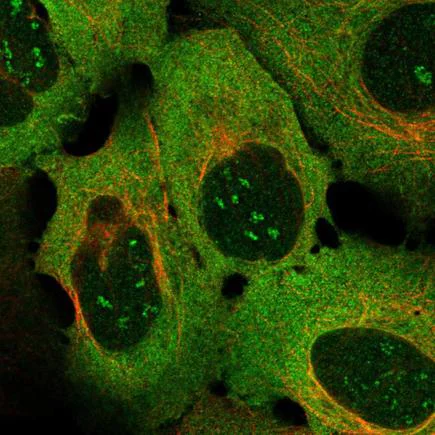 Immunocytochemistry/ Immunofluorescence - Anti-CD137 antibody (AB222213)