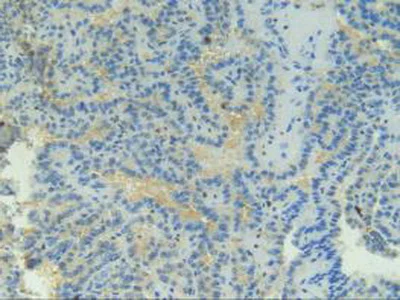 Immunohistochemistry (Formalin/PFA-fixed paraffin-embedded sections) - Anti-CD137 antibody (AB232990)