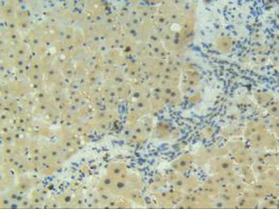 Immunohistochemistry (Formalin/PFA-fixed paraffin-embedded sections) - Anti-CD137 antibody (AB232990)