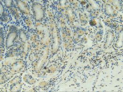 Immunohistochemistry (Formalin/PFA-fixed paraffin-embedded sections) - Anti-CD137 antibody (AB232990)