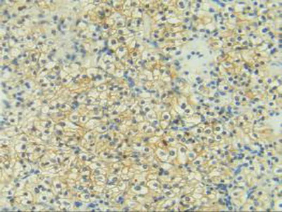 Immunohistochemistry (Formalin/PFA-fixed paraffin-embedded sections) - Anti-CD137 antibody (AB232990)