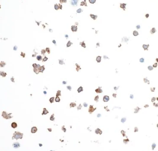 Immunocytochemistry/ Immunofluorescence - Anti-CD137 antibody [BLR051F] - BSA free (AB252559)