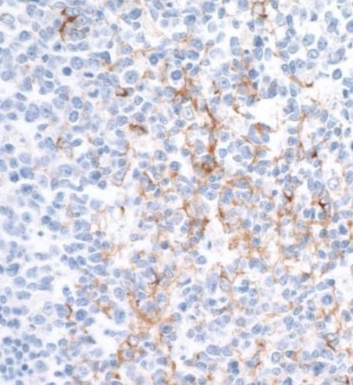 Immunohistochemistry (Formalin/PFA-fixed paraffin-embedded sections) - Anti-CD137 antibody [BLR051F] - BSA free (AB252559)