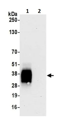 Immunoprecipitation - Anti-CD137 antibody [BLR051F] - BSA free (AB252559)