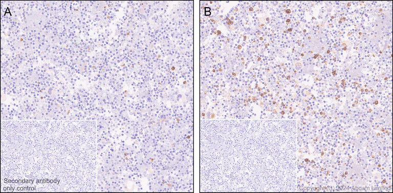 Immunohistochemistry (Formalin/PFA-fixed paraffin-embedded sections) - Anti-CD137 antibody [EPR29039-129] (AB322557)