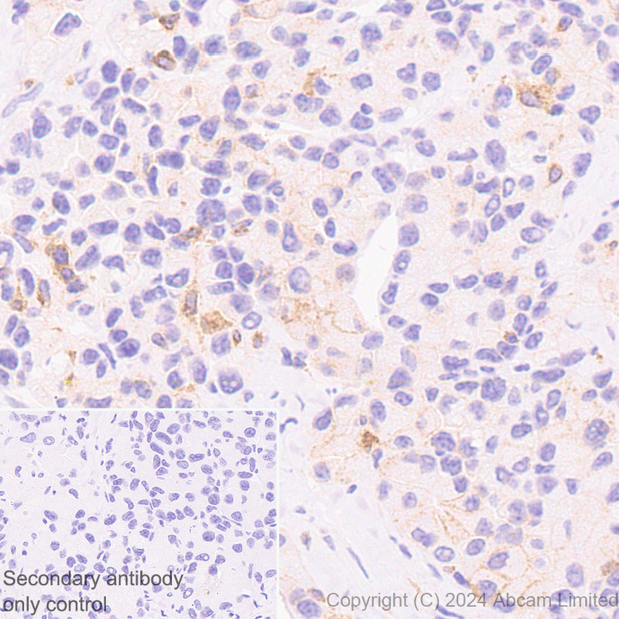 Immunohistochemistry (Formalin/PFA-fixed paraffin-embedded sections) - Anti-CD137 antibody [EPR29039-129] (AB322557), expandable thumbnail