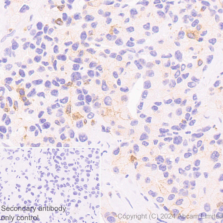 Immunohistochemistry (Formalin/PFA-fixed paraffin-embedded sections) - Anti-CD137 antibody [EPR29039-129] (AB322557)