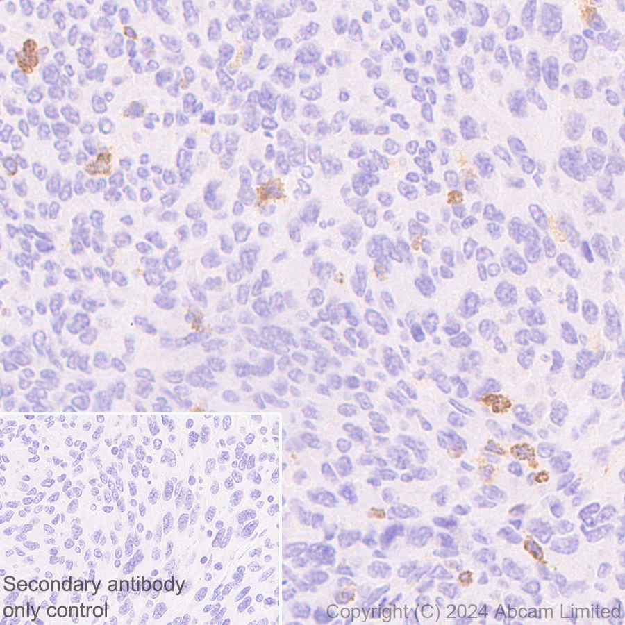 Immunohistochemistry (Formalin/PFA-fixed paraffin-embedded sections) - Anti-CD137 antibody [EPR29039-129] (AB322557), expandable thumbnail