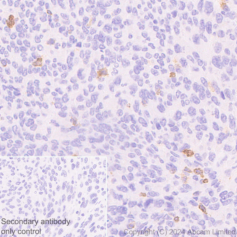 Immunohistochemistry (Formalin/PFA-fixed paraffin-embedded sections) - Anti-CD137 antibody [EPR29039-129] (AB322557)
