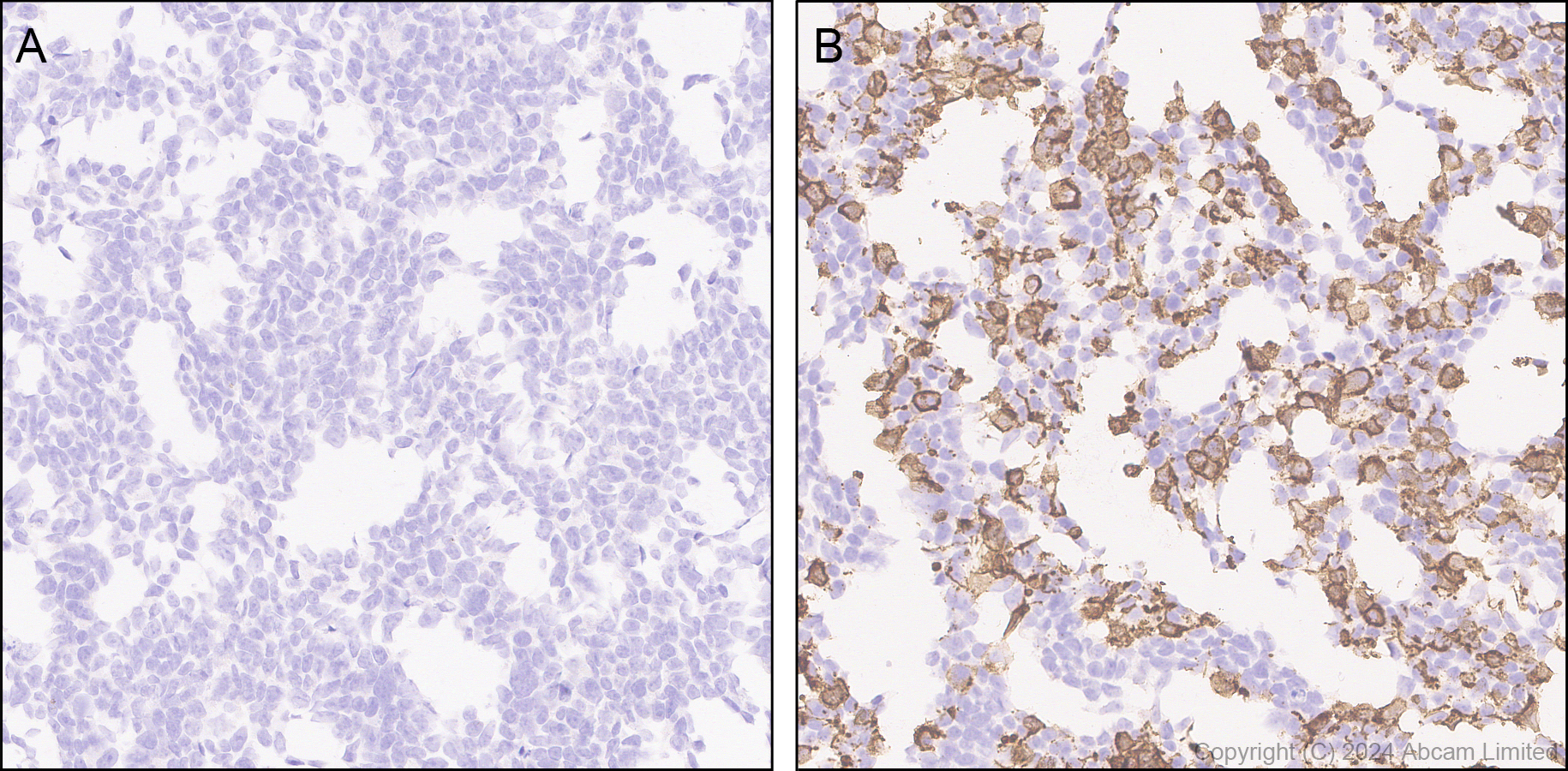 Immunohistochemistry (Formalin/PFA-fixed paraffin-embedded sections) - Anti-CD137 antibody [EPR29039-129] (AB322557), expandable thumbnail