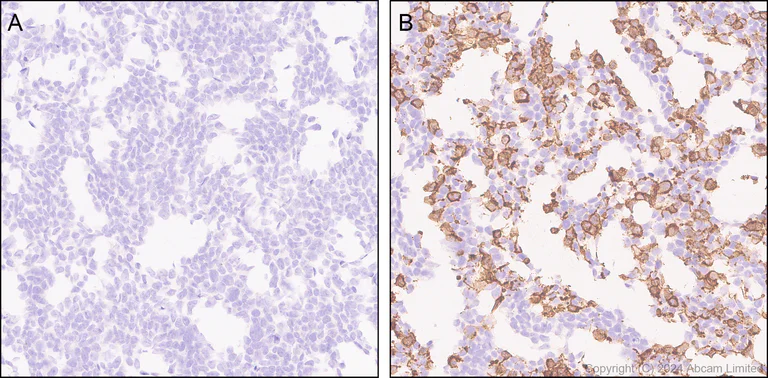 Immunohistochemistry (Formalin/PFA-fixed paraffin-embedded sections) - Anti-CD137 antibody [EPR29039-129] (AB322557)