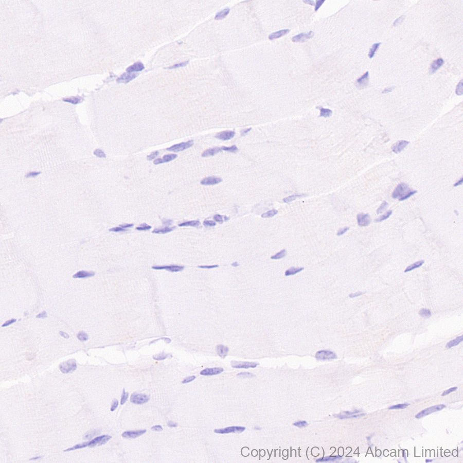 Immunohistochemistry (Formalin/PFA-fixed paraffin-embedded sections) - Anti-CD137 antibody [EPR29039-129] (AB322557), expandable thumbnail