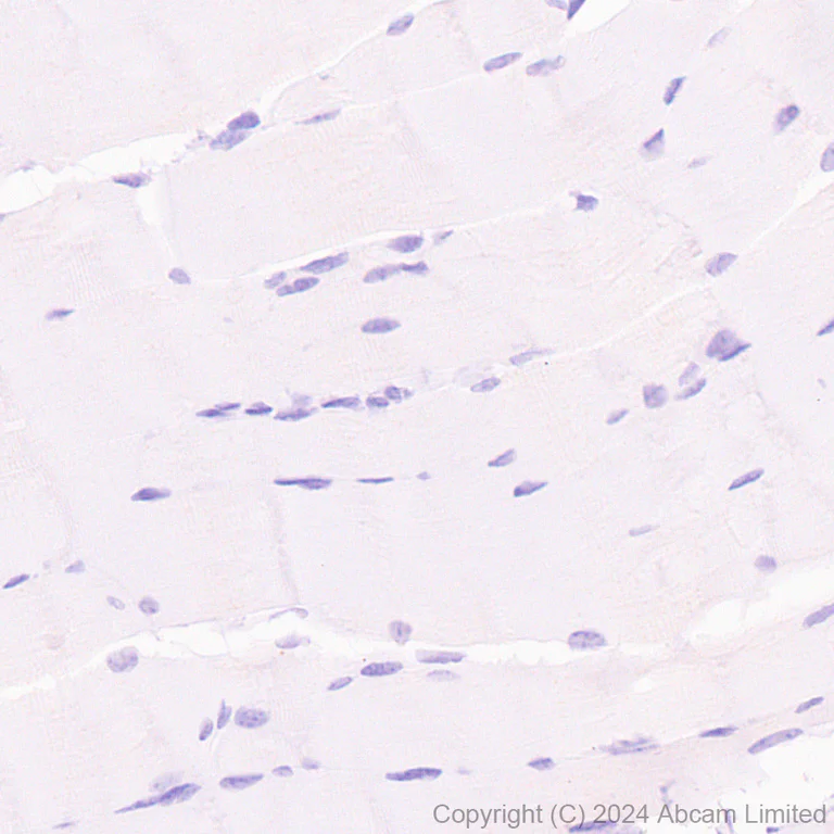 Immunohistochemistry (Formalin/PFA-fixed paraffin-embedded sections) - Anti-CD137 antibody [EPR29039-129] (AB322557)