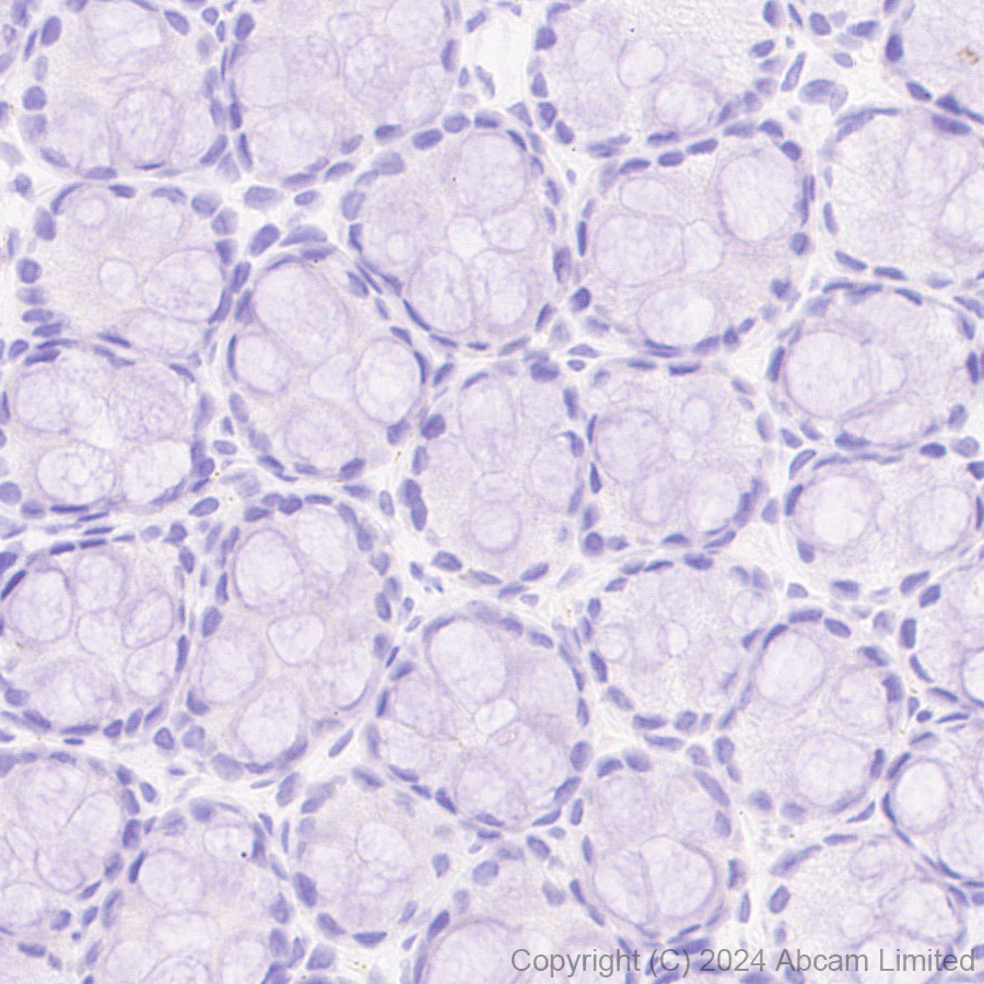 Immunohistochemistry (Formalin/PFA-fixed paraffin-embedded sections) - Anti-CD137 antibody [EPR29039-129] (ab322557), expandable thumbnail