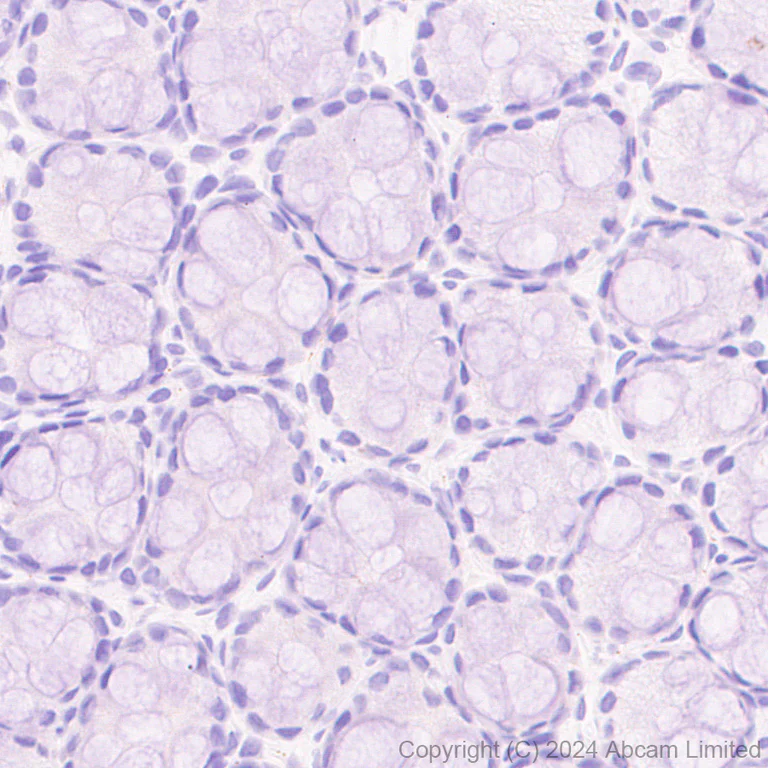 Immunohistochemistry (Formalin/PFA-fixed paraffin-embedded sections) - Anti-CD137 antibody [EPR29039-129] (AB322557)
