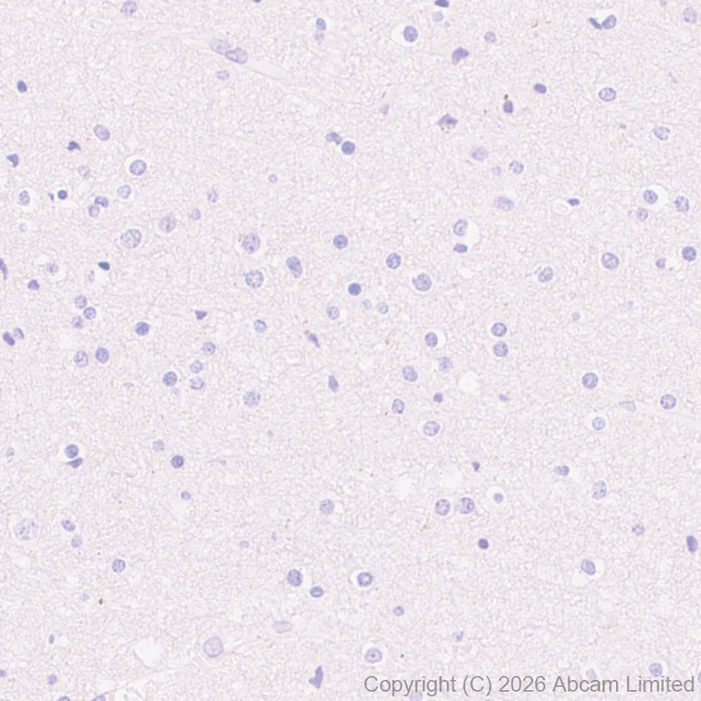 Immunohistochemistry (Formalin/PFA-fixed paraffin-embedded sections) - Anti-CD137 antibody [EPR30968-503] (AB326426)