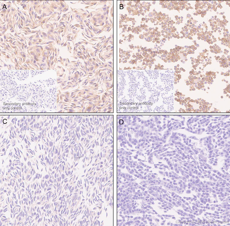 Immunohistochemistry (Formalin/PFA-fixed paraffin-embedded sections) - Anti-CD137 antibody [EPR30968-503] (AB326426)