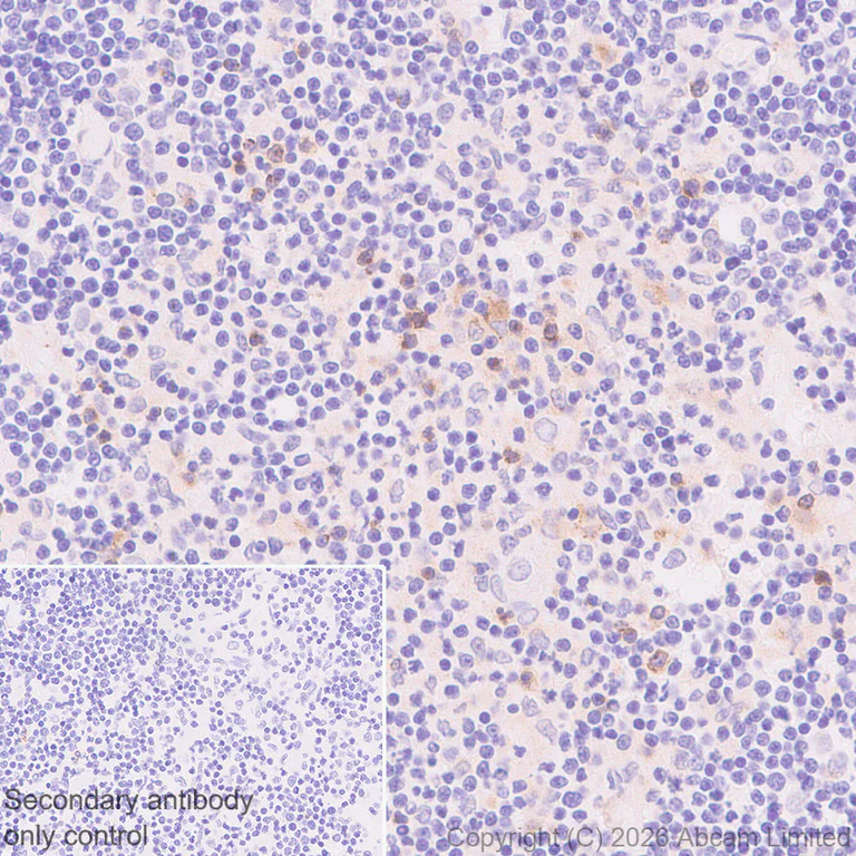 Immunohistochemistry (Formalin/PFA-fixed paraffin-embedded sections) - Anti-CD137 antibody [EPR30968-503] - BSA and Azide free (AB326429)