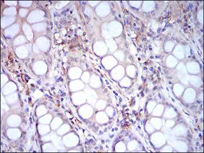 Immunohistochemistry (Formalin/PFA-fixed paraffin-embedded sections) - Anti-CD14 antibody [1H5D8] (AB181470), expandable thumbnail