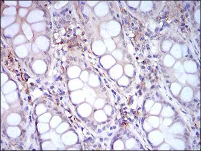 Immunohistochemistry (Formalin/PFA-fixed paraffin-embedded sections) - Anti-CD14 antibody [1H5D8] (AB181470)