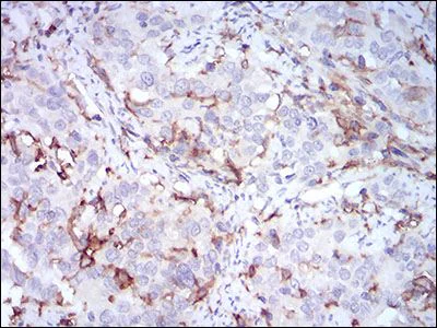 Immunohistochemistry (Formalin/PFA-fixed paraffin-embedded sections) - Anti-CD14 antibody [1H5D8] (AB181470)
