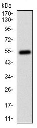 Western blot - Anti-CD14 antibody [1H5D8] (AB181470), expandable thumbnail