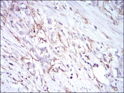 Immunohistochemistry (Formalin/PFA-fixed paraffin-embedded sections) - Anti-CD14 antibody [4B4F12] (AB182032)
