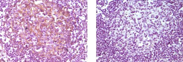 Immunohistochemistry (Formalin/PFA-fixed paraffin-embedded sections) - Anti-CD14 antibody [5A3B11B5] (AB36595)