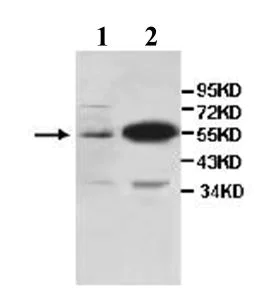 Western blot - Anti-CD14 antibody (AB106285)