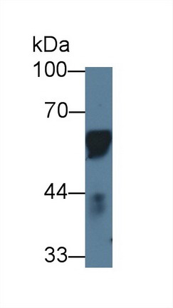 Western blot - Anti-CD14 antibody (AB231049), expandable thumbnail