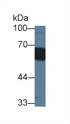 Western blot - Anti-CD14 antibody (AB231049), expandable thumbnail
