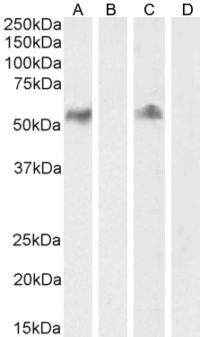 Western blot - Anti-CD14 antibody (AB45870), expandable thumbnail