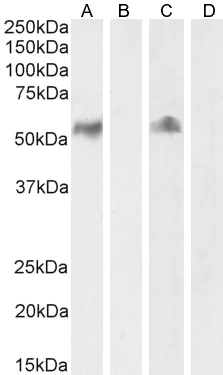 Western blot - Anti-CD14 antibody (AB45870)