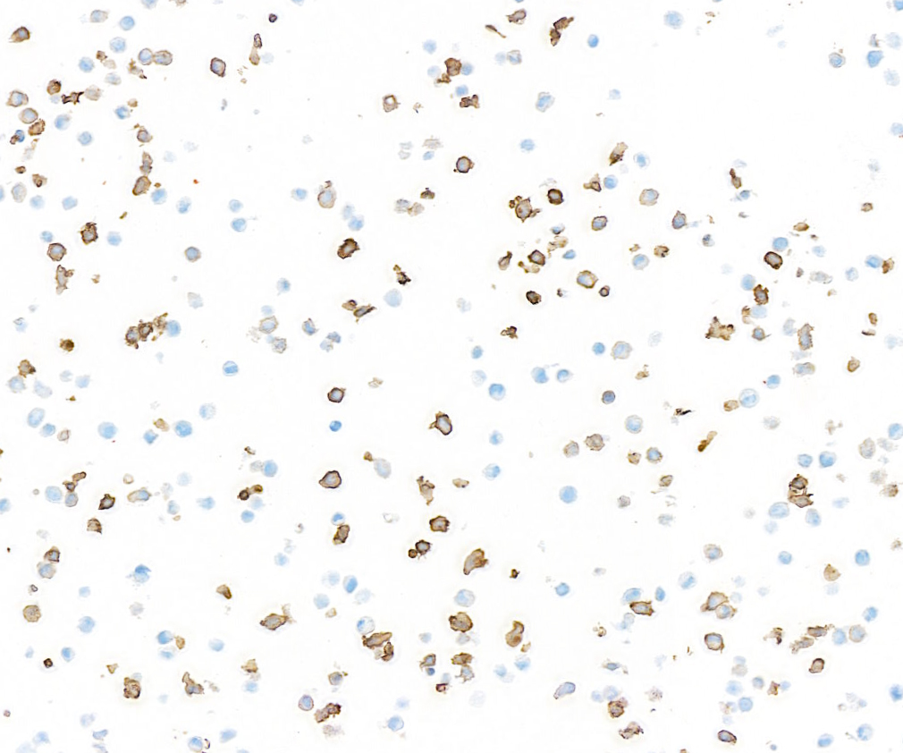 Immunocytochemistry - Anti-CD14 antibody [BLR187J] - BSA free (AB314062), expandable thumbnail