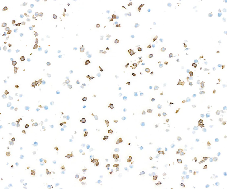 Immunocytochemistry - Anti-CD14 antibody [BLR187J] - BSA free (AB314062)