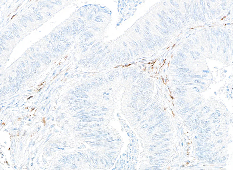 Immunohistochemistry (Formalin/PFA-fixed paraffin-embedded sections) - Anti-CD14 antibody [BLR187J] - BSA free (AB314062)