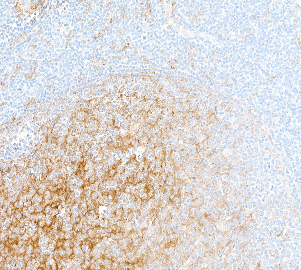 Immunohistochemistry (Formalin/PFA-fixed paraffin-embedded sections) - Anti-CD14 antibody [BLR187J] - BSA free (AB314062), expandable thumbnail
